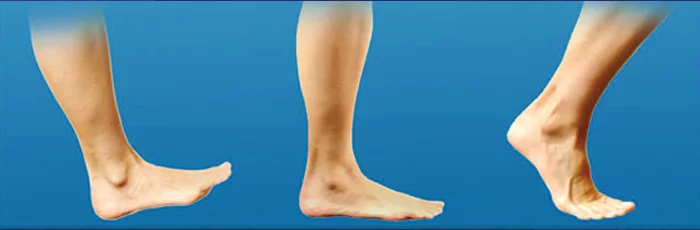 برای پیاده روی صحیح، گام برداشتن درست به صورت غلتشی است.